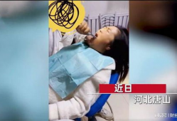 拔智齿视频,视频带你直观体验